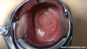Double-titted, silicone-boobed sweetheart takes a deep-speculum ride