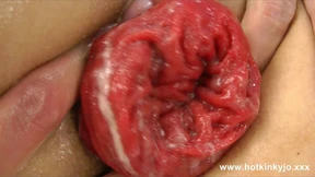 Dig with Fist in the Ass & Anal Prolapse by Hotkinkyjo