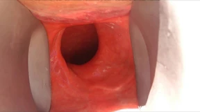 Deep penetration of her anus with large speculum and massive dildo