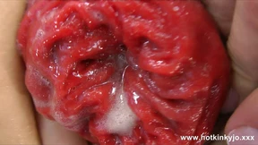 Hotkinkyjo Bottle Anal Insertion and Prolapse Push Out