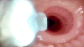 A detailed examination of Lopuza93 oral cavity and anal area using an endoscope camera A detailed examination of Lopuza93 oral cavity and anal area using an endoscope camera