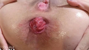 Hot Brazilian Girl Giving Her Ass and Cumming! Anal Prolapse
