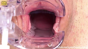 Cervix of Shy MILF Revealed! Cervix of Shy MILF Revealed!