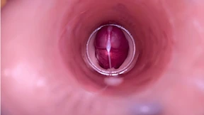 Female Insemination - Internal Camera Captures Deep Male Ejaculation