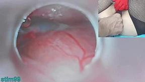 Japanese uterus creampie with cum, cervix cam, uterine exploration, uncensored womb invasion Japanese uterus creampie with cum, cervix cam, uterine exploration, uncensored womb invasion