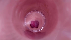 Female Insemination - Internal Camera Captures Deep Male Ejaculation