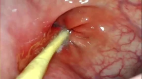 EXTREME ANAL POV CAMERA INSIDE HER ASSHOLE AS I POUND HER WITH MY BIG COCK AND CUM DEEP INSIDE EXTREME ANAL POV CAMERA INSIDE HER ASSHOLE AS I POUND HER WITH MY BIG COCK AND CUM DEEP INSIDE