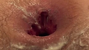chunky chick's ass🍑 expansion & cunnilingus Fluffy muff & stretched hole Anal👌 obsession chunky chick's ass🍑 expansion & cunnilingus Fluffy muff & stretched hole Anal👌 obsession