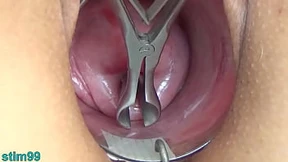 Japanese Pregnancy Video with Cervical Semen Injection and Uterine Endoscopy Japanese Pregnancy Video with Cervical Semen Injection and Uterine Endoscopy