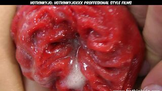 Hotkinkyjo Bottle Anal Insertion and Prolapse Push Out