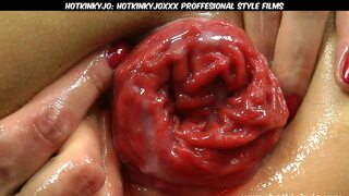 'Dirty anal👌 play, prolapse pleasure & big black plug invasion