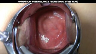 Double-titted, silicone-boobed sweetheart takes a deep-speculum ride